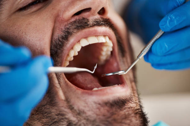 Dental Bonding in English Creek, NJ